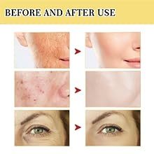 Snail Mucin Power Essence Moisturizer, 100ml Snail Mucin Essence Repairing Hyaluronic Acid Essence, Hydrating Serum For Face With Snail Secretion Filtrate For Dark Spots And Fine Lines Snail Mucin Power Essence Moisturizer, 100ml Snail Mucin Essence Repairing Hyaluronic Acid Essence, Hydrating Serum For Face With Snail Secretion Filtrate For Dark Spots And Fine Lines